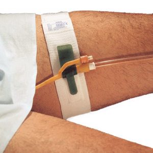 مراقبت از سوند ادراری