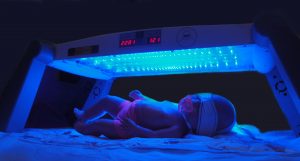 اجاره دستگاه زردی شیراز اجاره فوتوتراپی شیراز