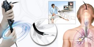 برونکوسکوپی