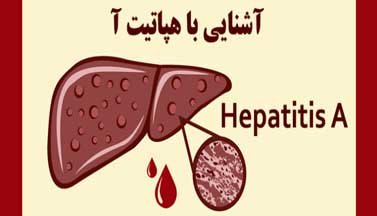 بیماری هپاتیت A