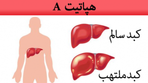 آشنایی هپاتیت آ
