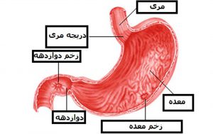 زخم-دوازدهه