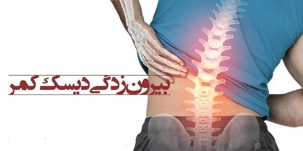 عمل دیسک کمر