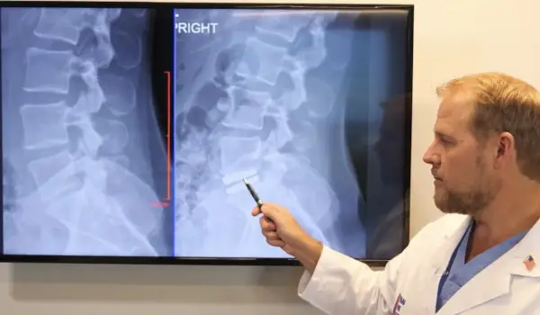 انواع عمل دیسک کمر