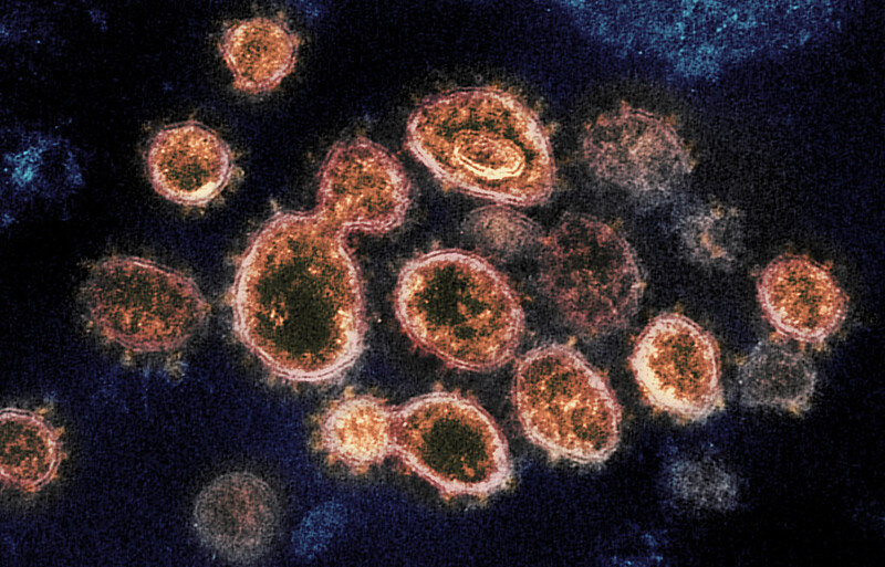 ویروس های مشابه با کرونا ویروس