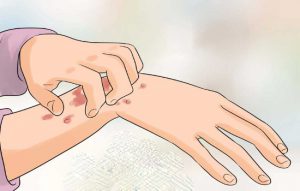 شناخت بیماری سلیاک