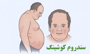 سندروم کوشینگ چیست ؟