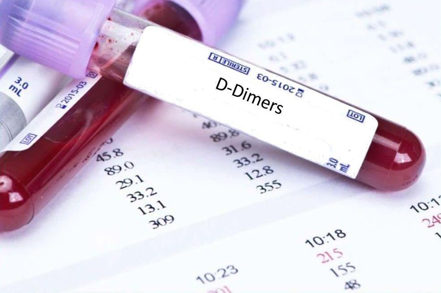 آزمایش D-dimer چه تستی است