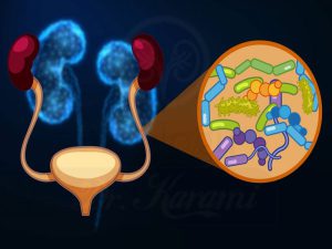 عفونت دستگاه ادراری (UTI) چیست؟