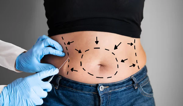 تصاویر لیپوساکشن