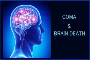 تفاوت مرگ مغزی و کما