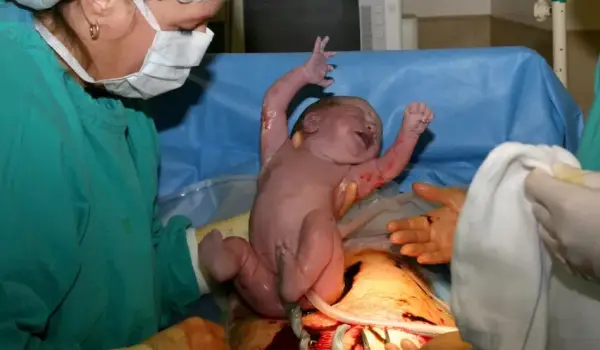 درد و عوارض پس از سزارین