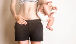 مراقبتهای بعد از زایمان