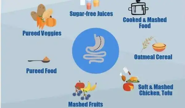 رعایت رژیم غذای بعد از عمل اسلیو