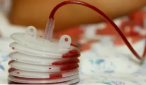 مراقبت از درن هموواکو (Hemovac)