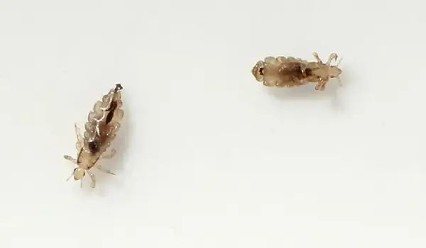 علائم شپش سر