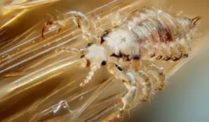 بهترین روش درمان شپش سر بچه ها و بزرگسالان