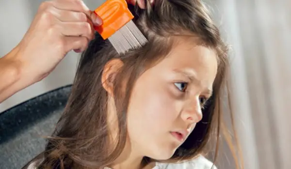  درمان خانگی شپش سر بچه ها