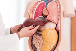 درمان کبد چرب