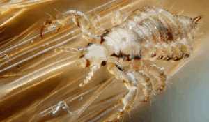 چرا درمان شپش شکست می‌خورد