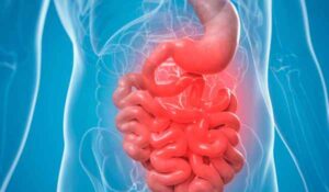 درمان خانگی دل پیچه