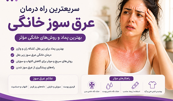 درمان خانگی عرق سوز شدن