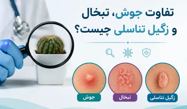 عکس زگیل تناسلی