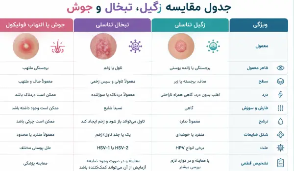 تفاوت جوش، تبخال و زگیل تناسلی چیست؟